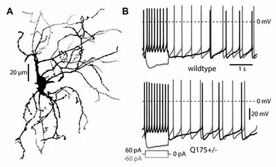 Cholinergic Interneurons Amplify Corticostriatal Synaptic Responses in the Q175 Model of Huntington’s Disease